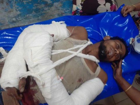সালথায় এক যুবককে কুপিয়ে হত্যার চেষ্টা হাত পা কেটে দিলো কয়েক যুবক।