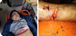পায়ের রগ ও চুরির আঘাতে বিএনপির নেতাকে হত্যা