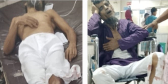 পটিয়া থানার নিরবতায় আহত পরিবার নিরাপত্তাহীনতায়: পূর্ব মালিয়ারা জামে মসজিদে রক্তাক্ত হামলার তিনদিনেও মামলা রুজু হয়নি