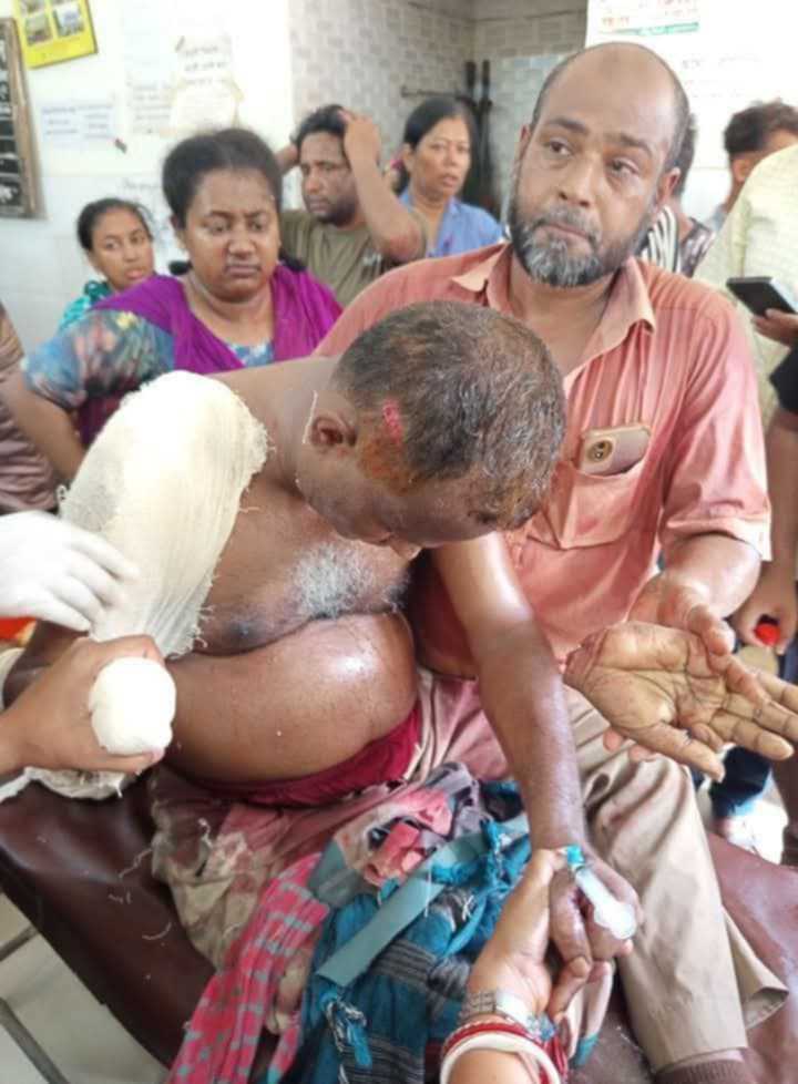 নড়াইলের লোহাগড়ায়  দুর্বৃত্তদের হামলায় কব্জি হারালেন বিএনপি নেতা