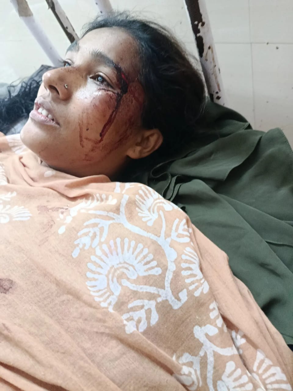 চট্টগ্রামে ‘সিন্টু বাহিনীর’ নারকীয় হামলা: পাঁচ নারী গুরুতর আহত, এলাকাবাসীর মাঝে চরম আতঙ্ক