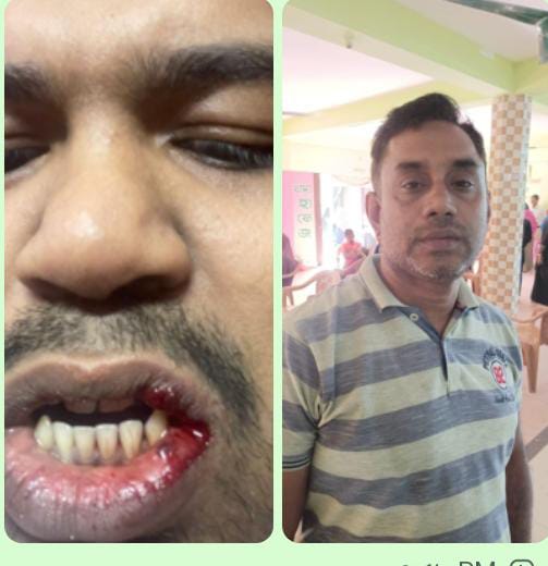 চাঁদগাঁও ৫ নম্বর ওয়ার্ডে বিএনপির নাম ভাঙিয়ে মোঃ ইব্রাহিমের চাঁদাবাজি ও সন্ত্রাসী কর্মকাণ্ডে অতিষ্ঠ সাধারণ জনগণ