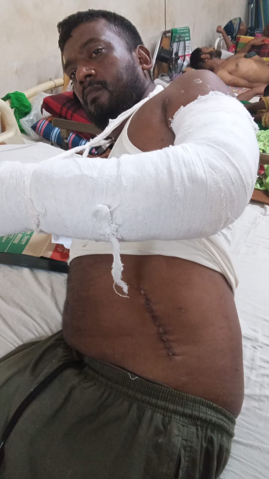 পার্বতীপুরে জমিজমা সংক্রান্ত বিরোধে প্রতিপক্ষের হামলায় যুবক গুরুতর আহত, থানায় মামলা